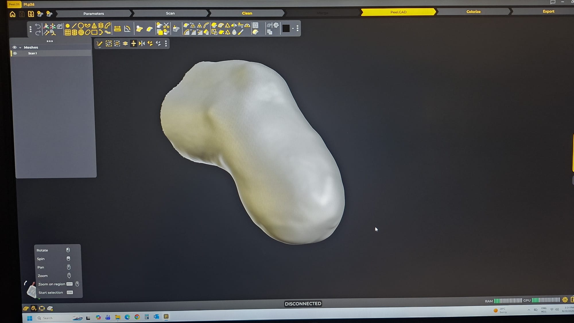 Scanare 3D picior amputat în vederea realizării unei proteze